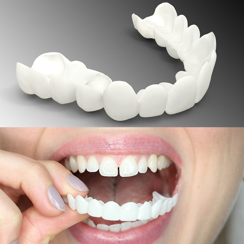 snap on smile