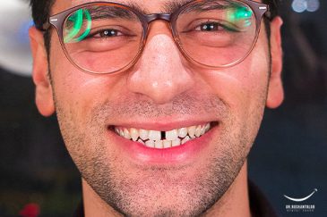 فاصله بین دندان ها