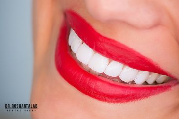 لمینیت کامپوزیتی