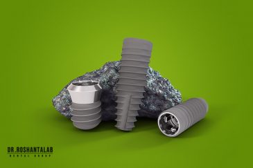 ایمپلنت اشترومن