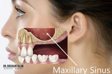 تحلیل لثه و استخوان فک