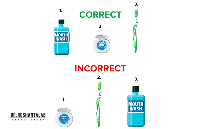 توصیههای بعد از ایمپلنت بدون درد و جراحی