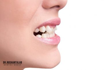 ارتودنسی یا عمل بینی