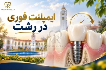 ایمپلنت فوری در رشت