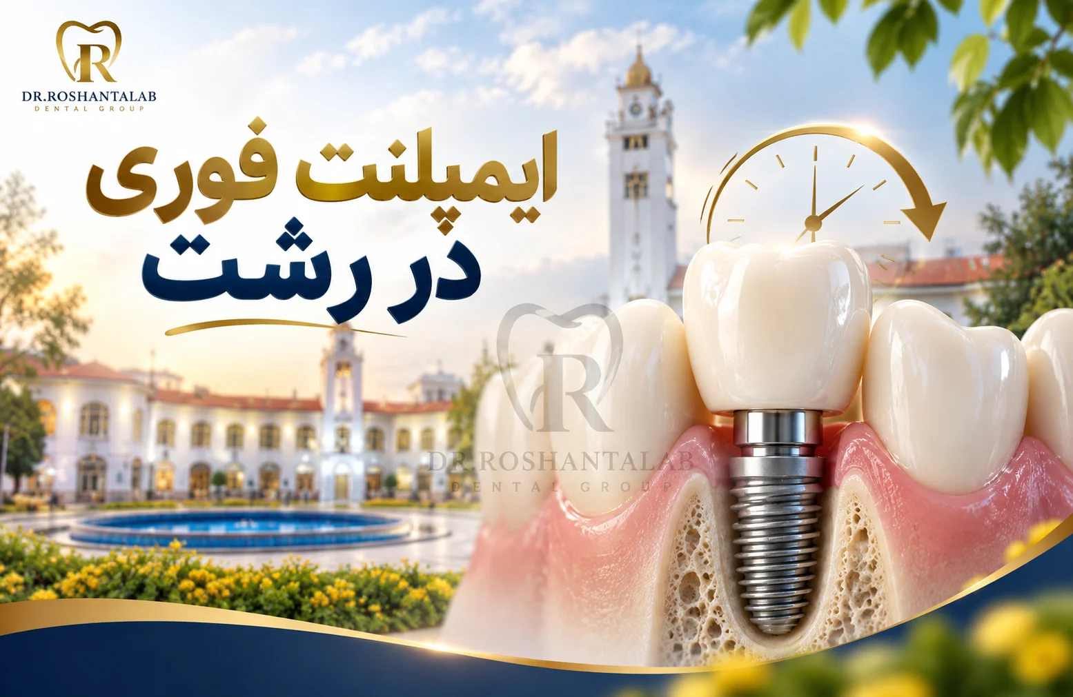 ایمپلنت فوری در رشت