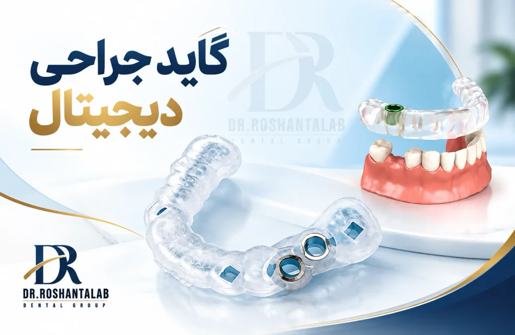 طراحی و ساخت گاید جراحی ایمپلنت
