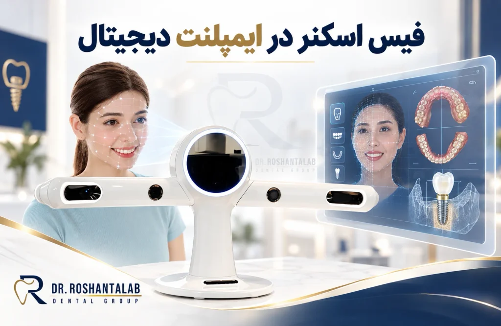 فیس اسکنر در ایمپلنت دیجیتال در رشت