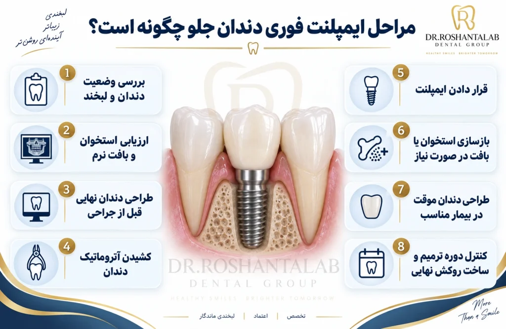 مراحل ایمپلنت فوری دندان جلو