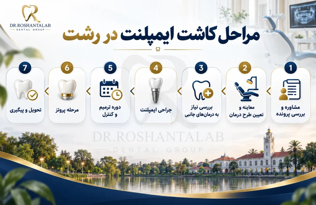 مراحل کاشت ایمپلنت در رشت