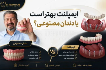 ایمپلنت بهتر است یا دندان مصنوعی؟