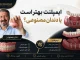 ایمپلنت بهتر است یا دندان مصنوعی؟