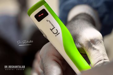 ایمپلنت دیجیتال