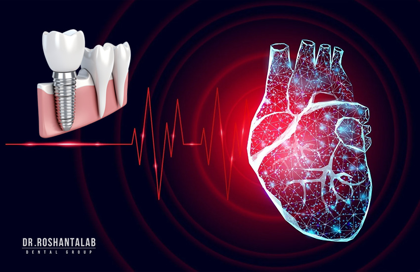 کاشت ایمپلنت برای چه کسانی مناسب نیست؟