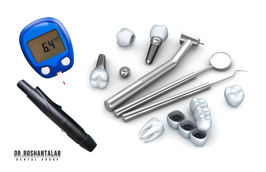 کاشت ایمپلنت برای چه کسانی مناسب نیست؟ دیابت