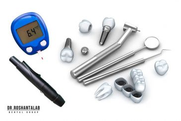 آیا بیماران دیابتی می توانند ایمپلنت کنند؟