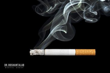 تاثیر سیگار بر ایمپلنت دندان