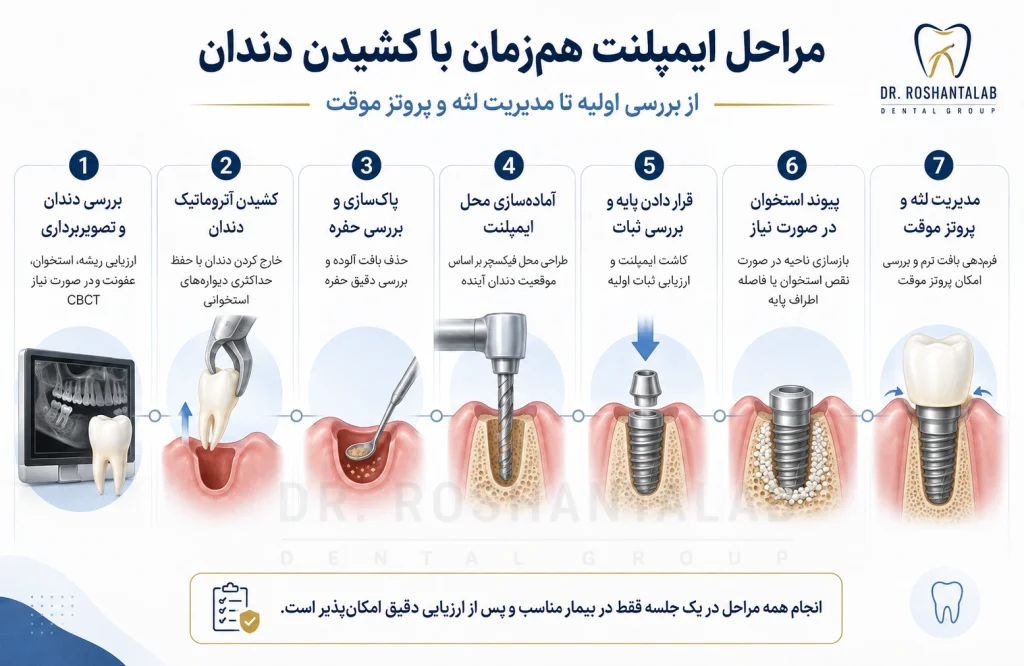 مراحل ایمپلنت همزمان با کشیدن دندان