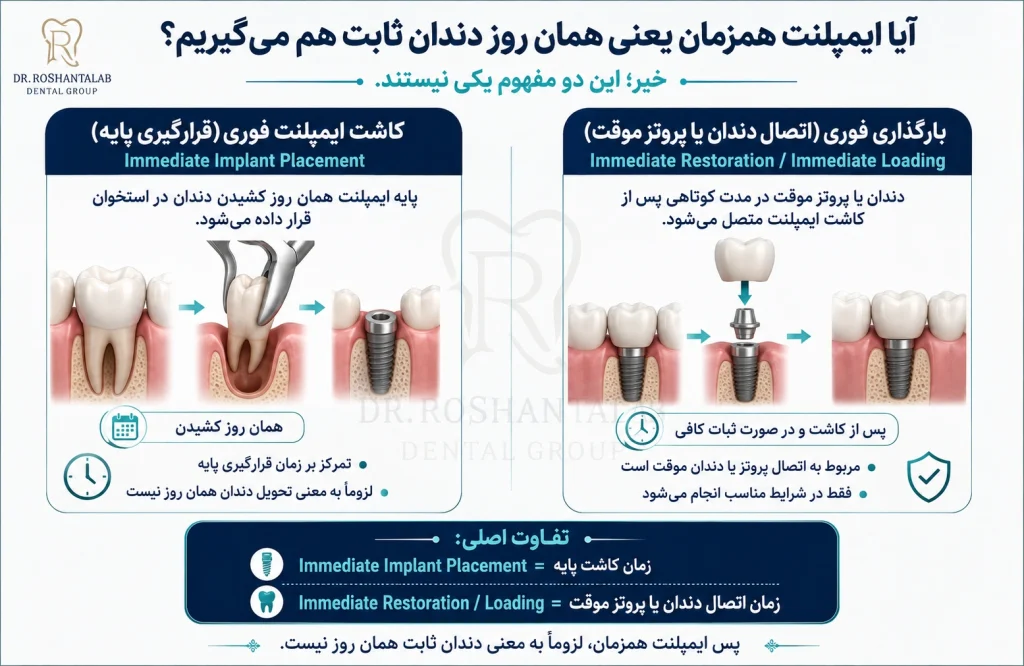 ایمپلنت فوری بعد از کشیدن دندان