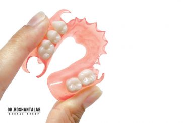پروتز دندان پارسیل| مزایا، معایب و انواع آن
