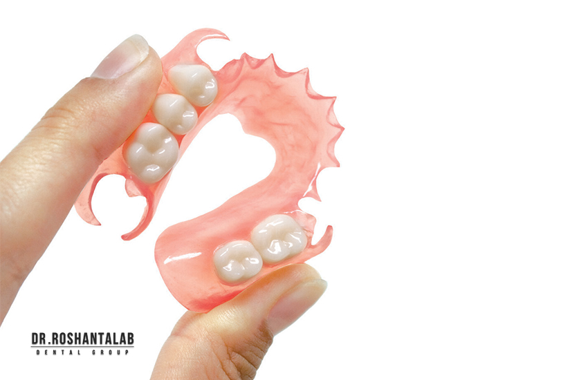 پروتز دندان پارسیل| مزایا، معایب و انواع آن
