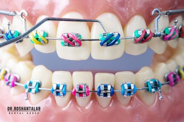 ارتودنسی دندان