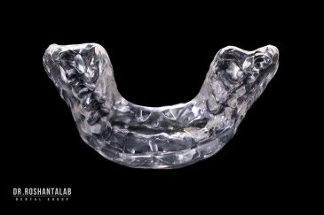 نایت گارد یا محافظ دندان قروچه