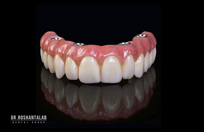 اوردنچر