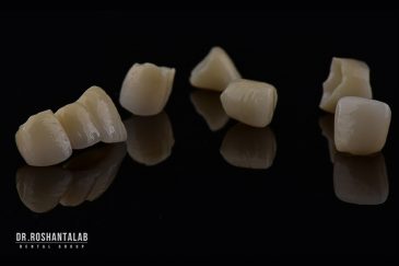 علت درد دندان پس از روکش