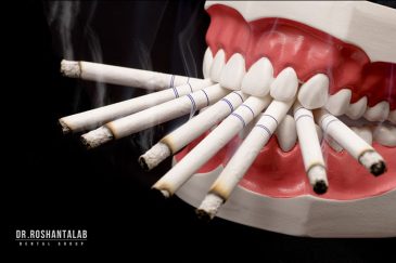 تاثیر سیگار بر ایمپلنت