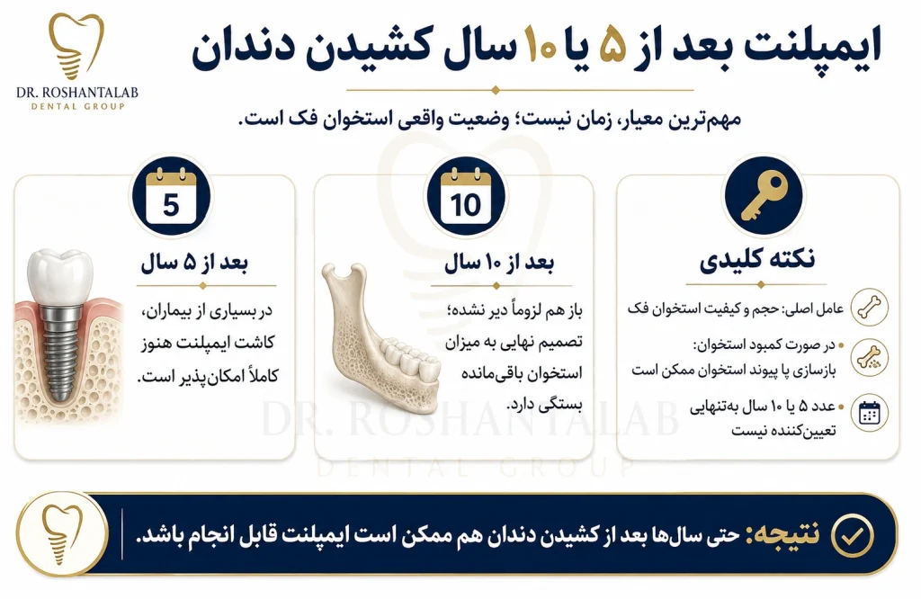 ایمپلنت بعد از 5 یا 10 سال کشیدن دندان