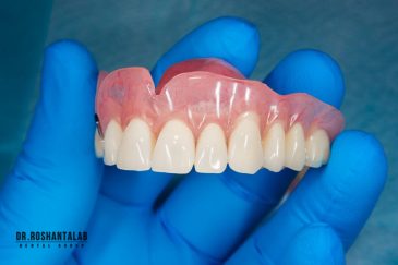 دندان مصنوعی ژله ای