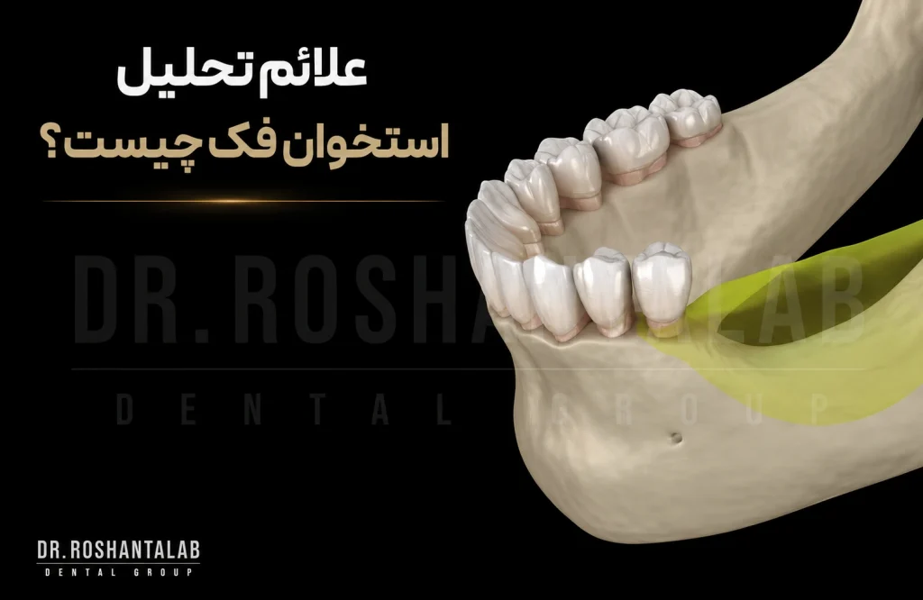 تحلیل استخوان فک بعد از کشیدن دندان