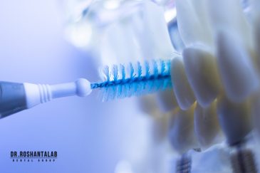 اهمیت بهداشت دندان در طول عمر ایمپلنت