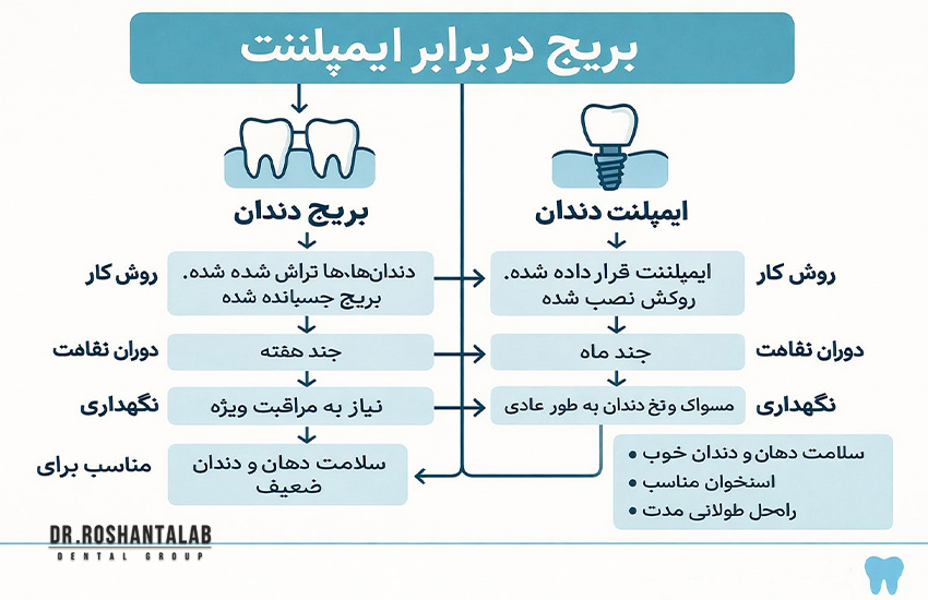 تفاوت ایمپلنت با بریج : کدام بهتر است؟