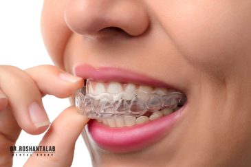 ارتودنسی نامرئی با پلاک های شفاف