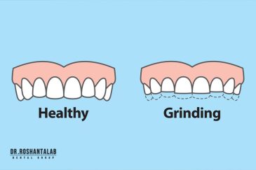 علل و روش های درمان دندان قروچه چیست؟