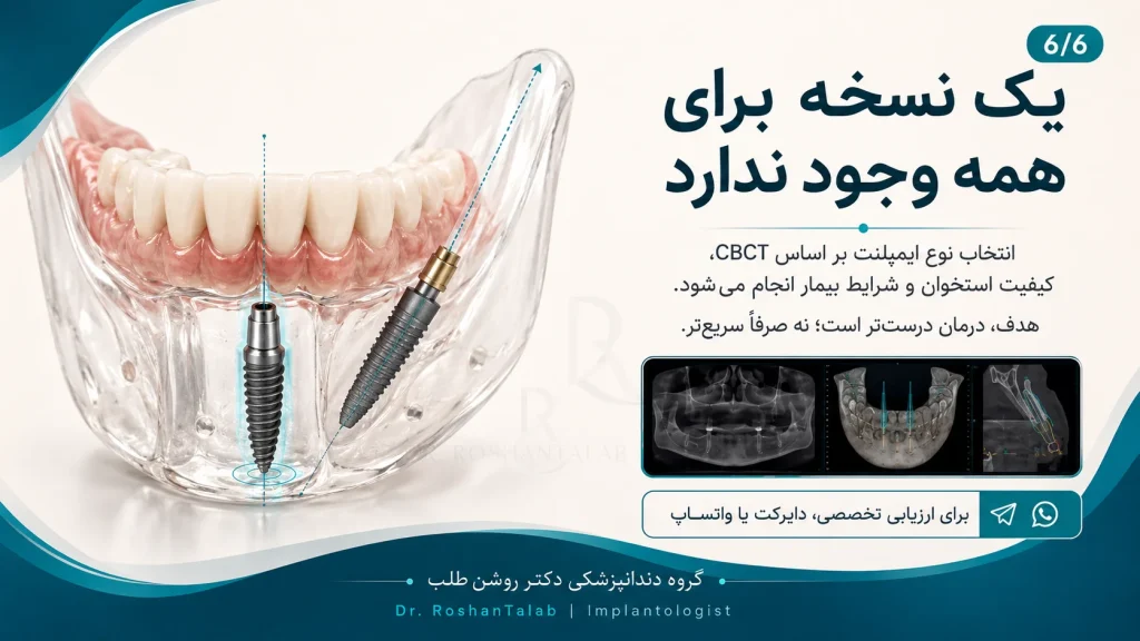 خدمات دندانپزشکی در کلینیک ایمپلنت دکتر روشن‌طلب
