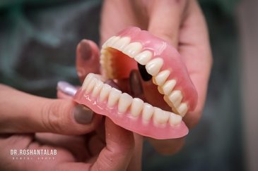 فاصله بین کشیدن دندان تا دندان مصنوعی