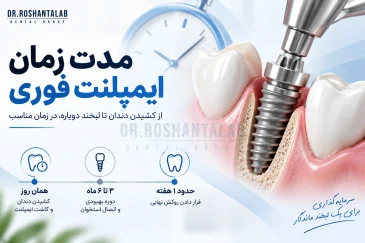 مدت زمان ایمپلنت فوری؛ 7 مرحله از جراحی تا روکش نهایی