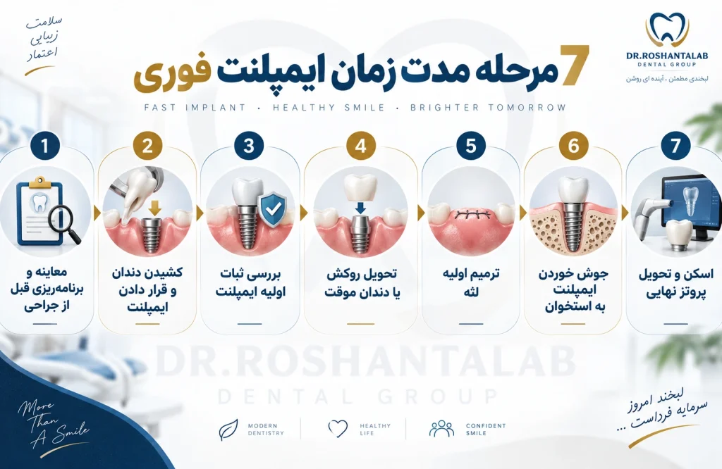 7 مرحله مدت زمان ایمپلنت فوری