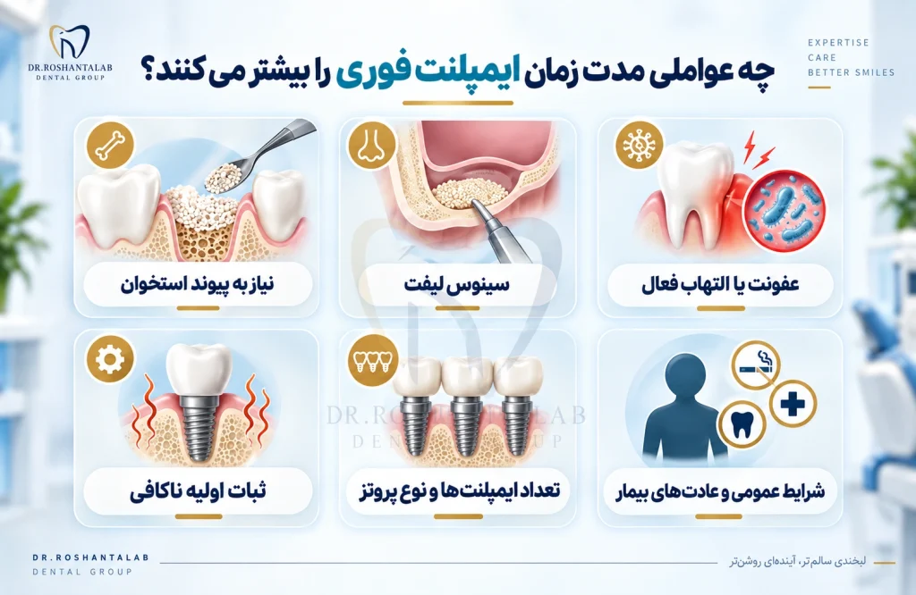 چه عواملی مدت زمان ایمپلنت فوری را بیشتر می‌کنند؟
