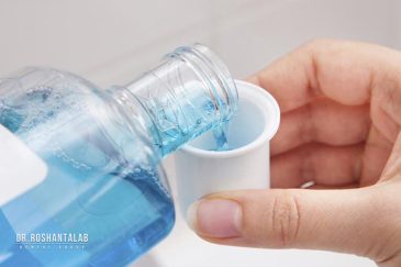 دهانشویه برای ایمپلنت دندان