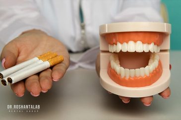 ایمپلنت دندان در افراد سیگاری چگونه انجام می شود؟