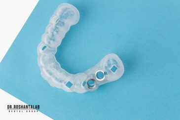 سرجیکال گاید ایمپلنت دندان