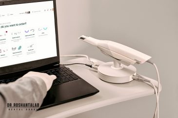 تفاوت اسکنر دهانی با قالب گیری سنتی چیست؟