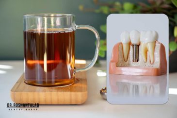 نوشیدن چای بعد از کاشت ایمپلنت دندان