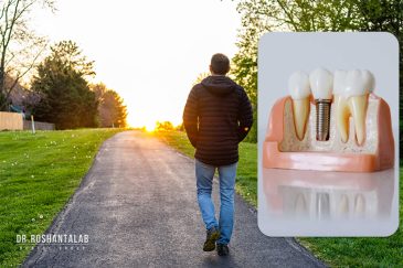 پیاده روی بعد از ایمپلنت دندان