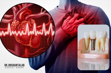 آیا کاشت ایمپلنت برای بیماران قلبی ضرر دارد؟