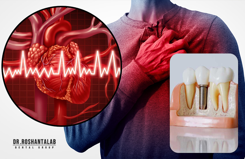 آیا کاشت ایمپلنت برای بیماران قلبی ضرر دارد؟