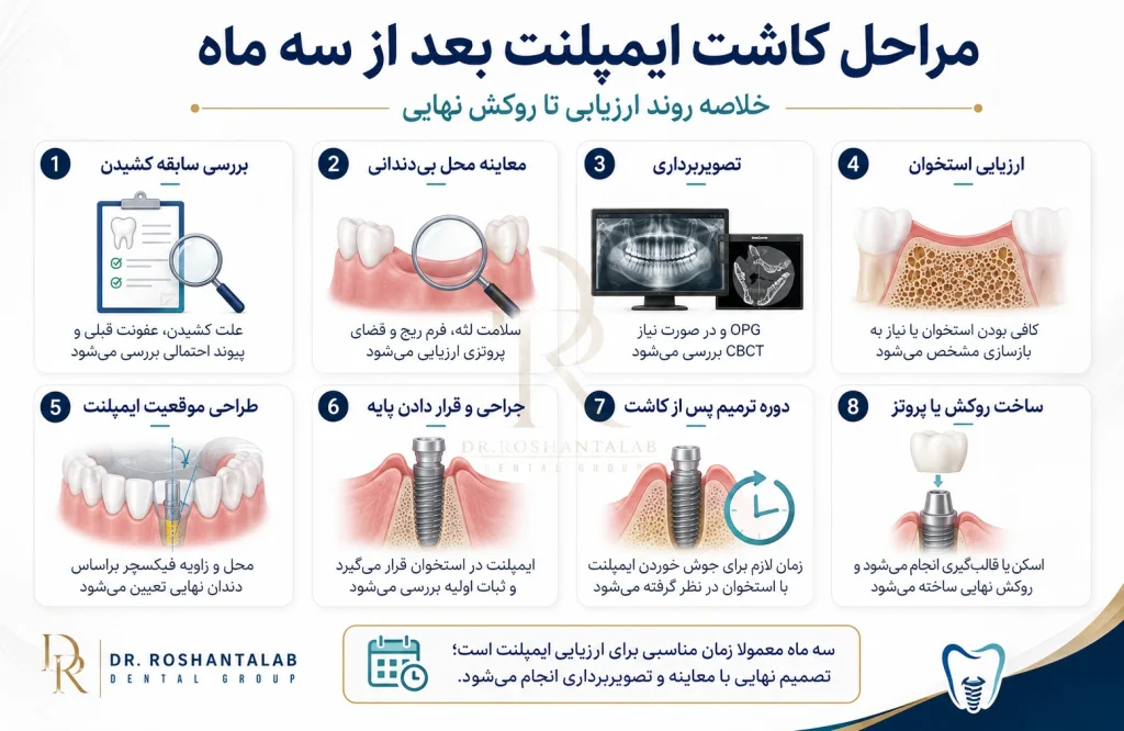 مراحل کاشت ایمپلنت بعد از سه ماه